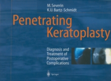 Penetrating Keratoplasty : Diagnosis and Treatment of Postoperative Complications