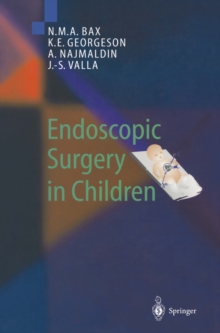 Endoscopic Surgery in Children