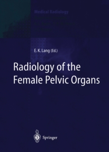 Radiology of the Female Pelvic Organs