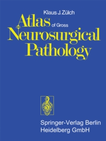 Atlas of Gross Neurosurgical Pathology