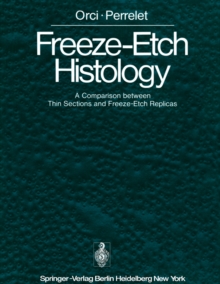 Freeze-Etch Histology : A Comparison between Thin Sections and Freeze-Etch Replicas