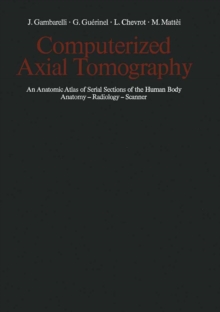 Computerized Axial Tomography : An Anatomic Atlas of Serial Sections of the Human Body Anatomy - Radiology - Scanner