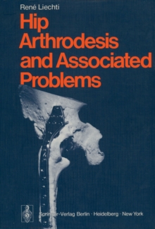 Hip Arthrodesis and Associated Problems