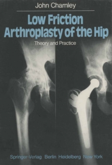 Low Friction Arthroplasty of the Hip : Theory and Practice