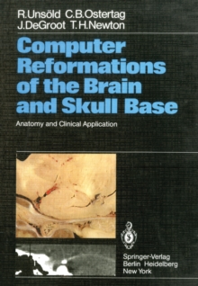 Computer Reformations of the Brain and Skull Base : Anatomy and Clinical Application