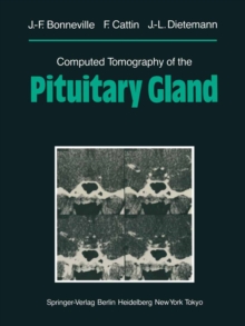 Computed Tomography of the Pituitary Gland : With a Chapter on Magnetic Resonance Imaging of the Sellar and Juxtasellar Region, By M. Mu Huo Teng and K. Sartor