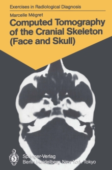 Computed Tomography of the Cranial Skeleton (Face and Skull) : 58 Radiological Exercises for Students and Practitioners