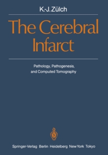 The Cerebral Infarct : Pathology, Pathogenesis, and Computed Tomography