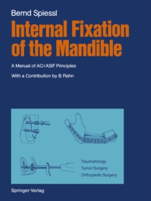 Internal Fixation of the Mandible : A Manual of AO/ASIF Principles