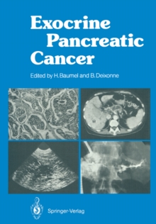 Exocrine Pancreatic Cancer