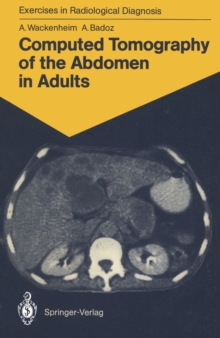 Computed Tomography of the Abdomen in Adults : 85 Radiological Exercises for Students and Practitioners