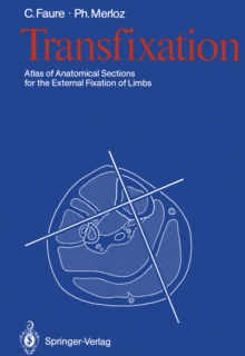 Transfixation : Atlas of Anatomical Sections for the External Fixation of Limbs