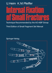 Internal Fixation of Small Fractures : Technique Recommended by the AO-ASIF Group