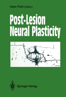 Post-Lesion Neural Plasticity