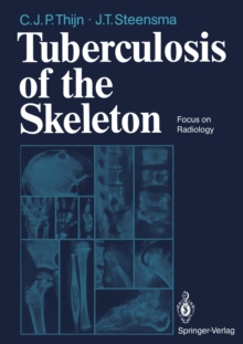 Tuberculosis of the Skeleton : Focus on Radiology