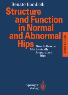 Structure and Function in Normal and Abnormal Hips : How to Rescue Mechanically Jeopardized Hips