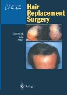 Hair Replacement Surgery : Textbook and Atlas