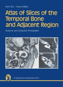 Atlas of Slices of the Temporal Bone and Adjacent Region : Anatomy and Computed Tomography Horizontal, Frontal, Sagittal Sections