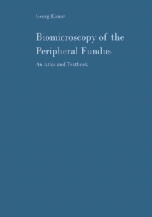 Biomicroscopy of the Peripheral Fundus : An Atlas and Textbook