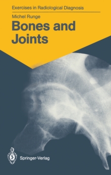 Bones and Joints : 170 Radiological Exercises for Students and Practitioners