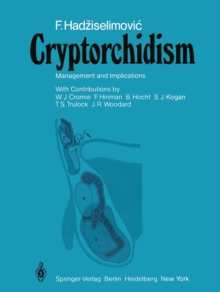 Cryptorchidism : Management and Implications