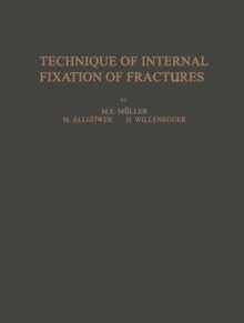 Technique of Internal Fixation of Fractures