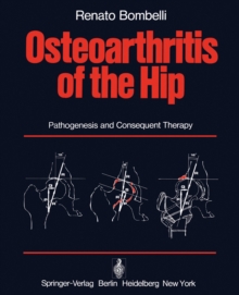 Osteoarthritis of the Hip : Pathogenesis and Consequent Therapy