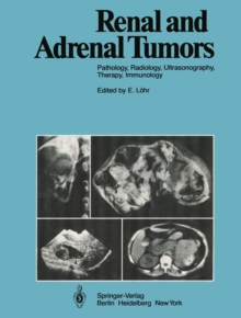 Renal and Adrenal Tumors : Pathology, Radiology, Ultrasonography, Therapy, Immunology