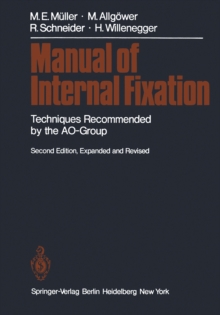 Manual of Internal Fixation : Techniques Recommended by the AO Group