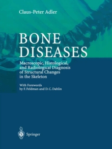 Bone Diseases : Macroscopic, Histological, and Radiological Diagnosis of Structural Changes in the Skeleton