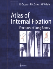 Atlas of Internal Fixation : Fractures of Long Bones