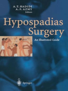 Hypospadias Surgery : An Illustrated Guide