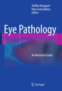 Eye Pathology : An Illustrated Guide