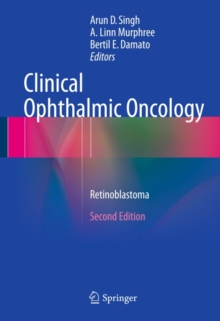 Clinical Ophthalmic Oncology : Retinoblastoma