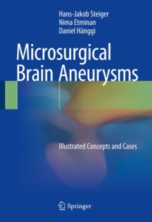 Microsurgical Brain Aneurysms : Illustrated Concepts and Cases