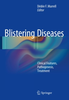 Blistering Diseases : Clinical Features, Pathogenesis, Treatment