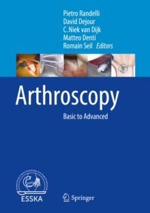 Arthroscopy : Basic to Advanced