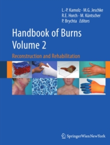 Handbook of Burns Volume 2 : Reconstruction and Rehabilitation