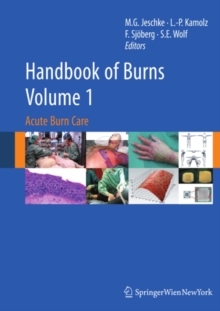 Handbook of Burns Volume 1 : Acute Burn Care