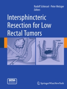 Intersphincteric Resection for Low Rectal Tumors