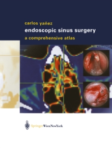 Endoscopic Sinus Surgery : A Comprehensive Atlas