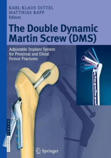 The Double Dynamic Martin Screw (DMS) : Adjustable Implant System for Proximal and Distal Femur Fractures, Hardback Book The Double Dynamic Martin Screw (DMS) : Adjustable Implant System for Proximal and Distal Femur Fractures, Hardback Book