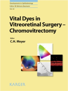 Vital Dyes in Vitreoretinal Surgery : Chromovitrectomy.