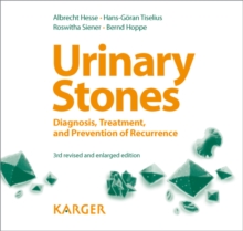 Urinary Stones : Diagnosis, Treatment, and Prevention of Recurrence Foreword by H.E. Williams (Davis, Calif.).