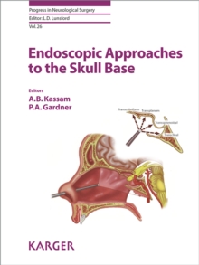 Endoscopic Approaches to the Skull Base