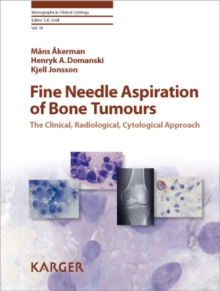 Fine Needle Aspiration of Bone Tumours : The Clinical, Radiological, Cytological Approach.