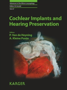 Cochlear Implants and Hearing Preservation