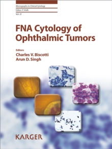 FNA Cytology of Ophthalmic Tumors