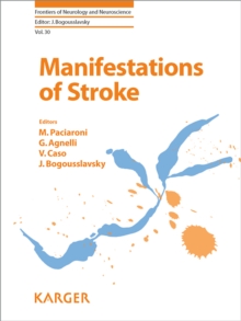 Manifestations of Stroke