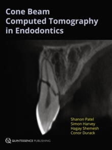 Cone Beam Computed Tomography in Endodontics